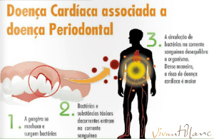 perioxcardio